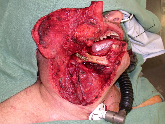 Operation Cut Throat 36